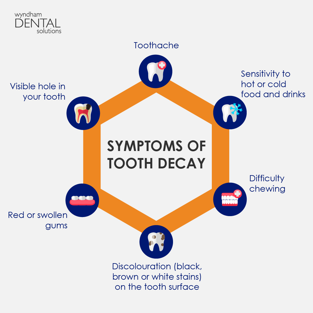 infographic-showing-symptoms-of-tooth-delay