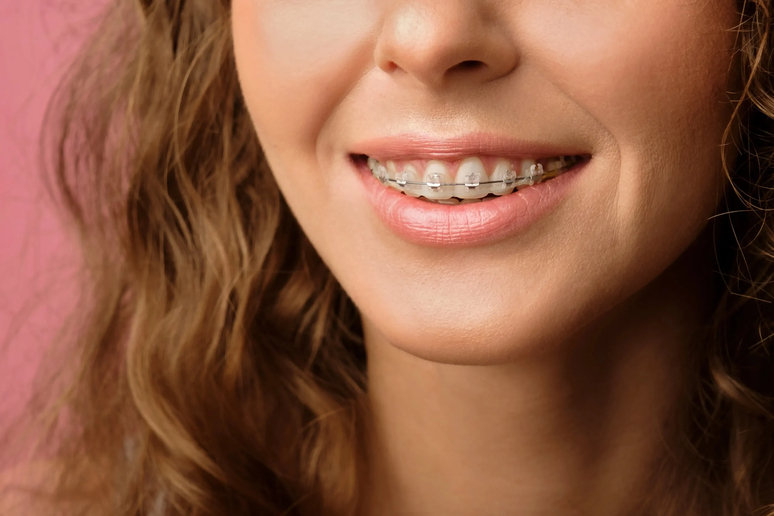 A young woman wearing braces and smiling