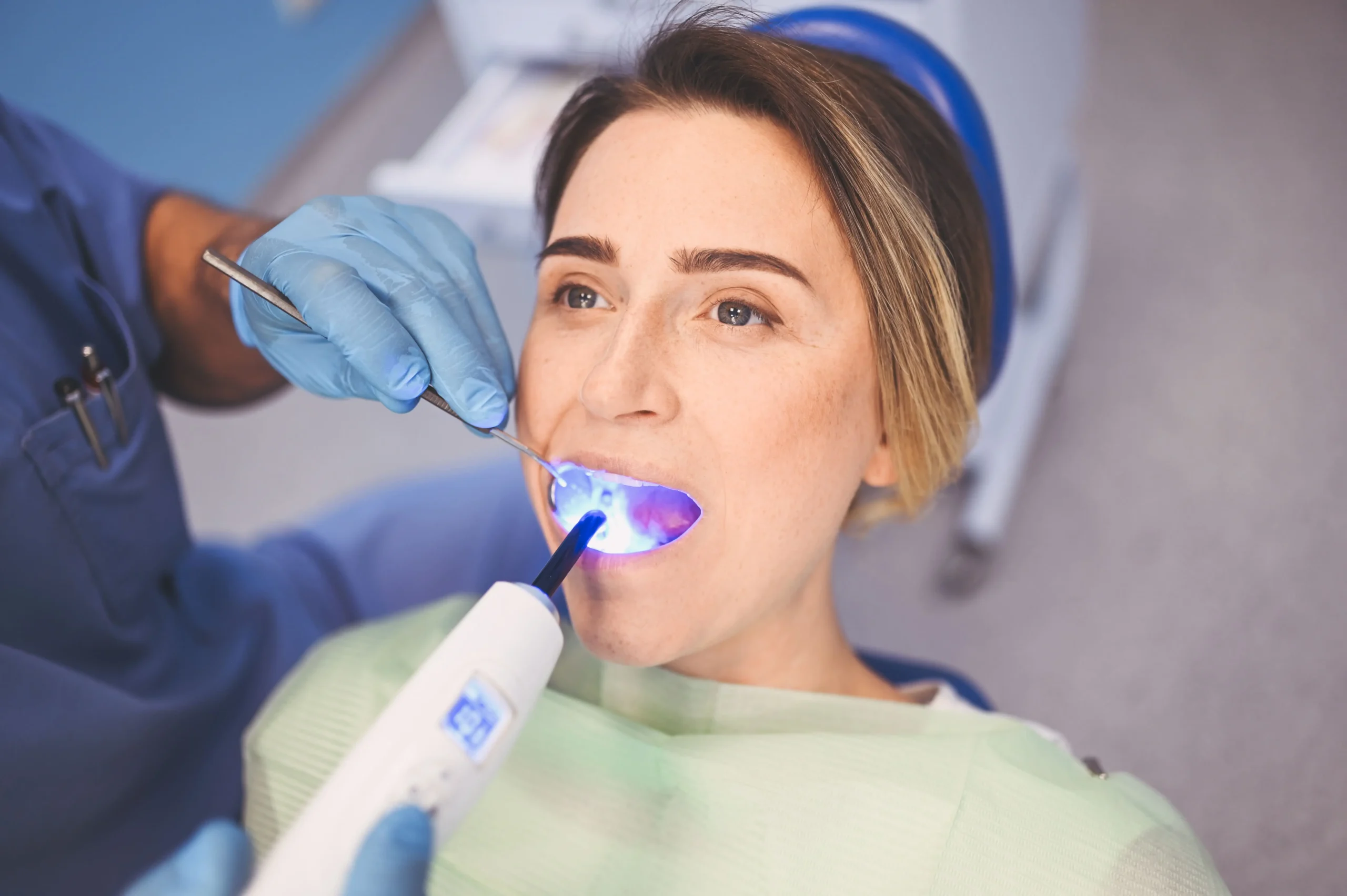 How Do I Know If I Need a Filling? Key Signs