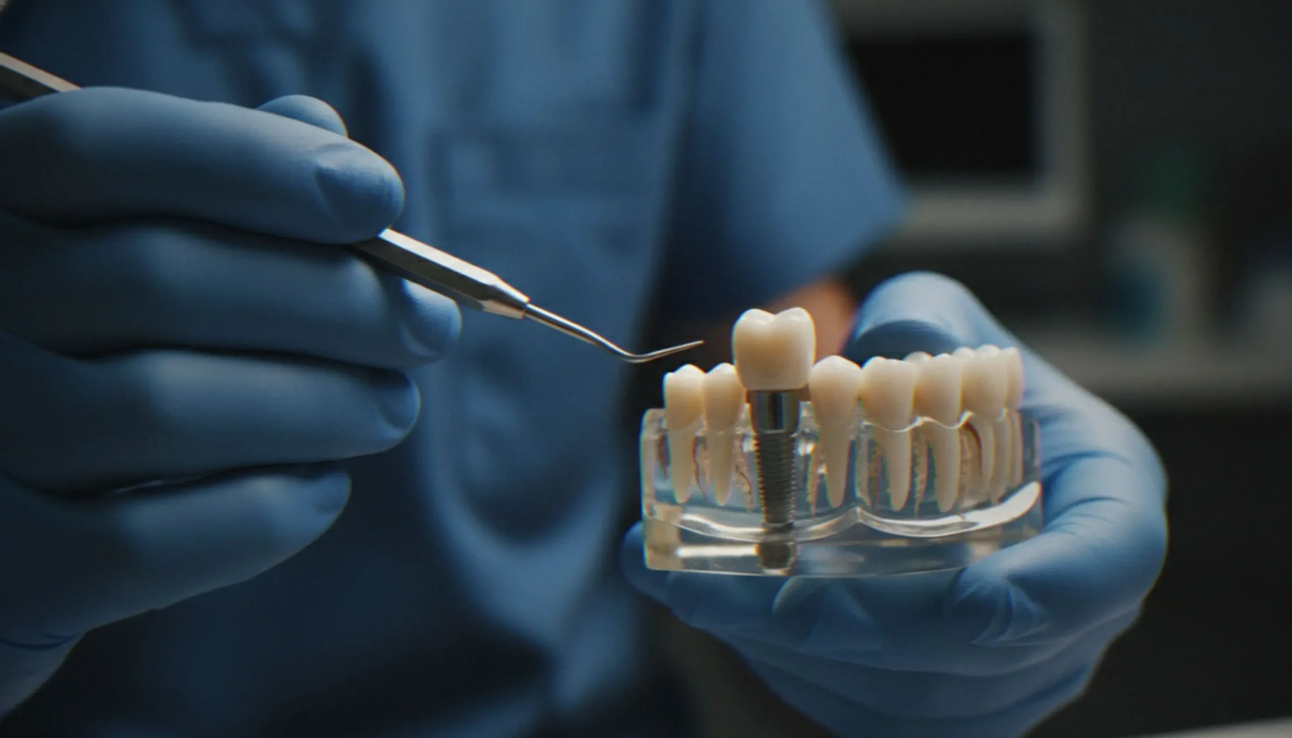 Options for Lost Teeth: Implants, Bridges & Dentures